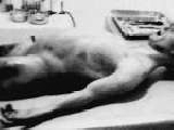 UFO - Area 51 Military Top Secret Alien Autopsy Roswell